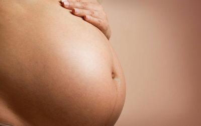 Prevenir les estries a l’embaràs: hidratació, dieta i genètica
